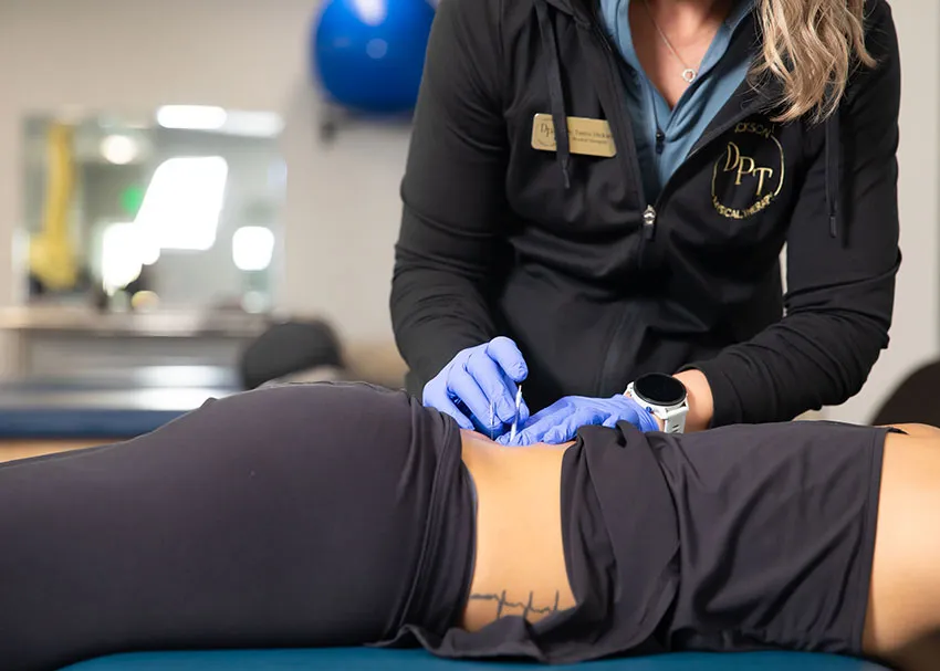 Close-up of dry needling on the low back